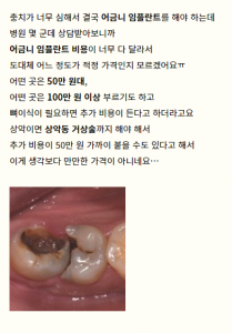 어금니-임플란트-가격-후기 (1)