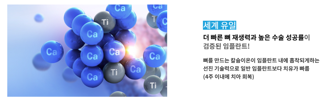 메가젠 임플란트 특징 2