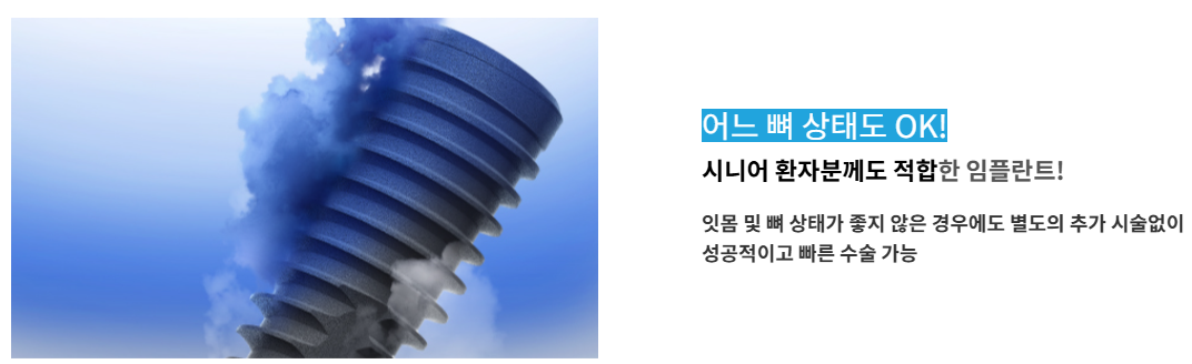 메가젠 임플란트 특징 4